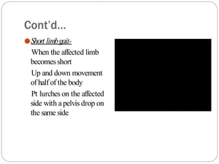 Cont’d…
●Short limbgait-
When the affected limb
becomesshort
Up and down movement
of halfof the body
Pt lurches on the affected
side with a pelvis drop on
the same side
 