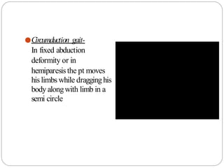 ●Circumduction gait-
In fixed abduction
deformity or in
hemiparesisthe pt moves
hislimbs while dragginghis
body alongwith limb in a
semi circle
 