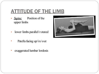 ATTITUDE OF THE LIMB
• Supine: Position of the
upper limbs
• lower limbs parallel/rotated
• Patellafacing up/in/out
• exaggerated lumbar lordosis
 