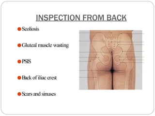 INSPECTION FROM BACK
●Scoliosis
●Gluteal muscle wasting
●PSIS
●Back of iliac crest
●Scarsand sinuses
 
