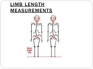 LIMB LENGTH
MEASUREMENTS
 