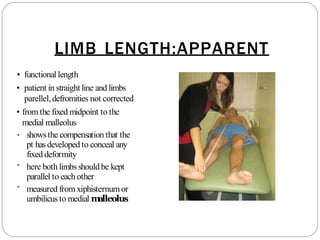 LIMB LENGTH:APPARENT
• functional length
• patient in straight line and limbs
parellel,defromities not corrected
• from the fixed midpoint to the
medial malleolus
•
•
• showsthe compensation that the
pt hasdeveloped to conceal any
fixed deformity
here both limbsshouldbe kept
parallel to each other
measured fromxiphisternum or
umbilicusto medial m
alleolus
 