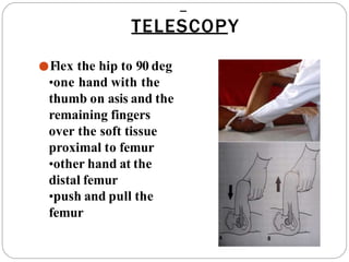 TELESCOPY
●Flex the hip to 90 deg
•one hand with the
thumb on asis and the
remaining fingers
over the soft tissue
proximal to femur
•other hand at the
distal femur
•push and pull the
femur
 