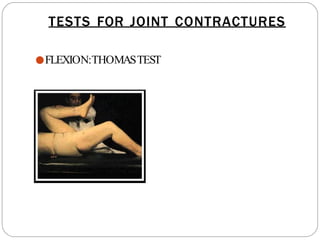 TESTS FOR JOINT CONTRACTURES
●FLEXION:THOMASTEST
 