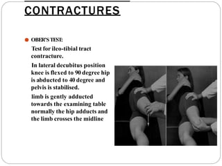 CONTRACTURES
● OBER’STEST:
Test for ileo-tibial tract
contracture.
In lateral decubitus position
knee is flexed to 90 degree hip
is abducted to 40 degree and
pelvis is stabilised.
limb is gently adducted
towards the examining table
normally the hip adducts and
the limb crosses the midline
 