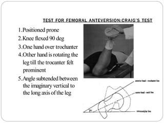 TEST FOR FEMORAL ANTEVERSION:CRAIG’S TEST
1.Positioned prone
2.Knee flexed 90 deg
3.One hand over trochanter
4.Other hand is rotating the
legtill the trocanter felt
prominent
5.Angle subtended between
the imaginaryvertical to
the long axis ofthe leg
 