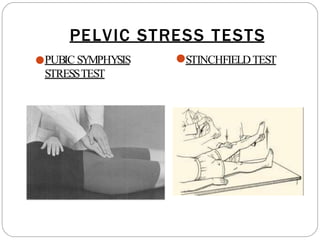 PELVIC STRESS TESTS
●PUBIC SYMPHYSIS ●STINCHFIELDTEST
STRESSTEST
 