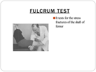 FULCRUM TEST
●It tests for the stress
fracturesof the shaft of
femur
 