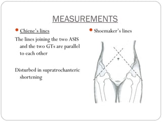 Clinical Examination of Hip | PPT