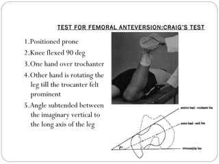Clinical Examination of Hip | PPT