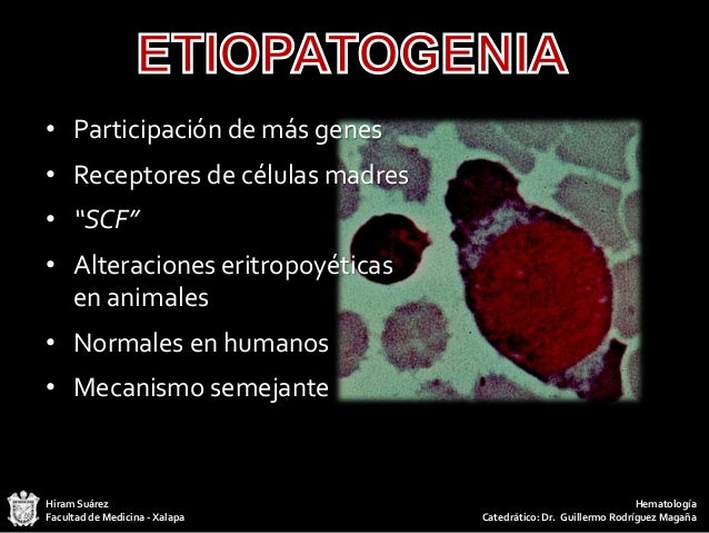 Aplasia pura de serie roja