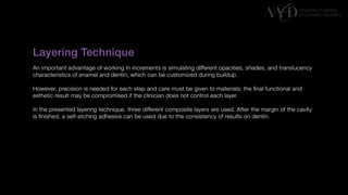 Traditional Layering vs. Modified Bulk Filling