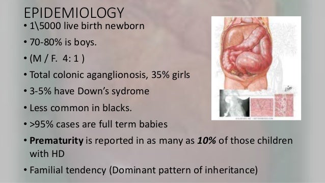 Hirchsprung's disease by Dr Afuye Olubunmi Olusola