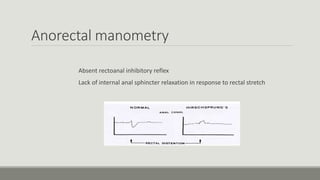 Anorectal manometry
Absent rectoanal inhibitory reflex
Lack of internal anal sphincter relaxation in response to rectal stretch
 