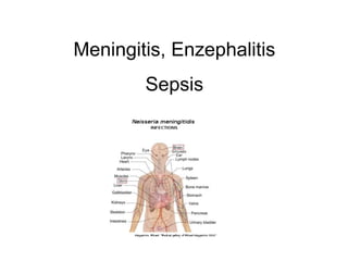 Meningitis, Enzephalitis
Sepsis
 