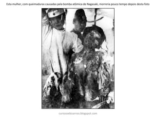 curiosoebizarroo.blogspot.com
Esta mulher, com queimaduras causadas pela bomba atômica de Nagasaki, morreria pouco tempo depois desta foto
 