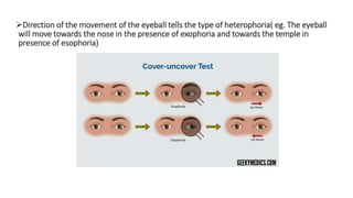 Direction of the movement of the eyeball tells the type of heterophoria( eg. The eyeball
will move towards the nose in the presence of exophoria and towards the temple in
presence of esophoria)
 