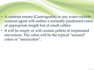 • A contrast enema (Gastrografin) or any water-soluble
contrast agent will outline a normally positioned colon
of appropriate length but of small caliber.
• It will be empty or will contain pellets of inspissated
meconium. The colon will be the typical “unused”
colon or “microcolon”.
 