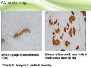 AChe staining
 