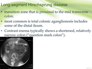 Long-segment Hirschsprung disease
• transition zone that is proximal to the mid transverse
colon.
• most common is total colonic aganglionosis includes
some of the distal ileum.
• Contrast enema typically shows a shortened, relatively
narrow colon (“question mark colon”).
 