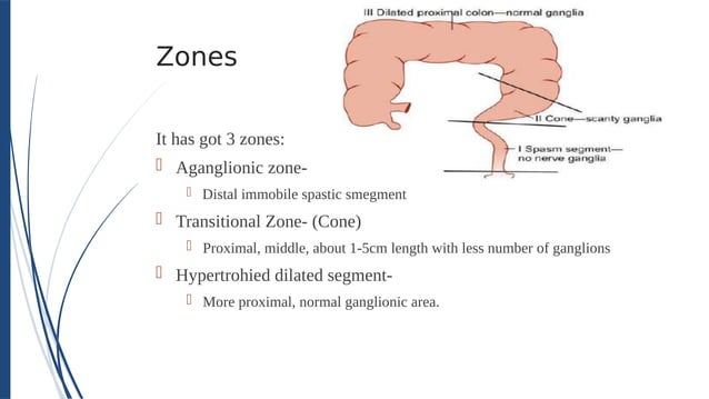 Long Segment Hirschsprung Disease - Approach & Management | PDF | Digestive ...