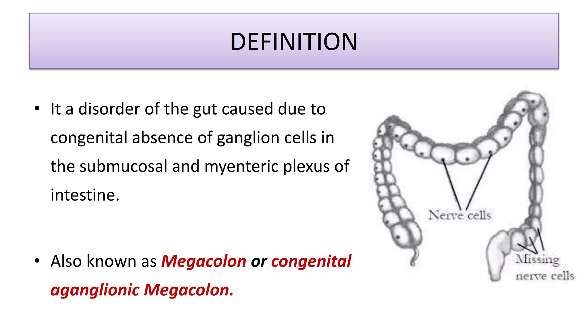 HIRSCHSPRUNG DISEASE | PPTX