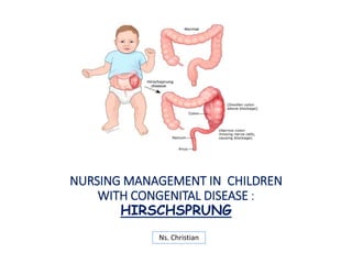 NURSING MANAGEMENT IN CHILDREN
WITH CONGENITAL DISEASE :
HIRSCHSPRUNG
Ns. Christian
 