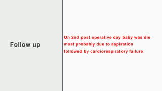 Follow up
On 2nd post operative day baby was die
most probably due to aspiration
followed by cardiorespiratory failure
 