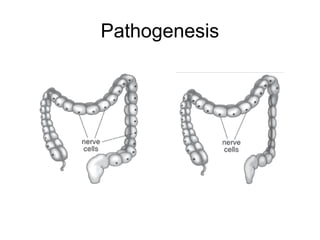 Pathogenesis
 