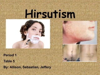 Hirsutism


Period 1
Table 5
By: Allison, Sebastian, Jeffery
 