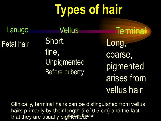 Hirsutism