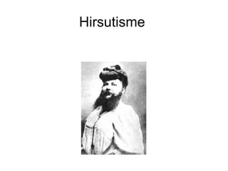 Hirsutisme  