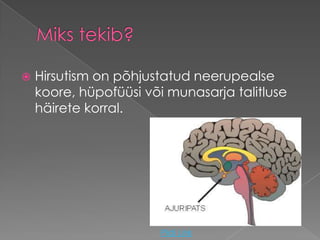    Hirsutism on põhjustatud neerupealse
    koore, hüpofüüsi või munasarja talitluse
    häirete korral.




                       Pildi Link
 