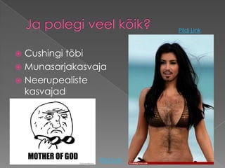 Pildi Link



 Cushingi tõbi
 Munasarjakasvaja
 Neerupealiste
  kasvajad




                Pildi Link
 