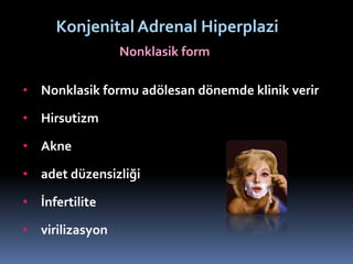 Nonklasik form
Konjenital Adrenal Hiperplazi
• Nonklasik formu adölesan dönemde klinik verir
• Hirsutizm
• Akne
• adet düzensizliği
• İnfertilite
• virilizasyon
 