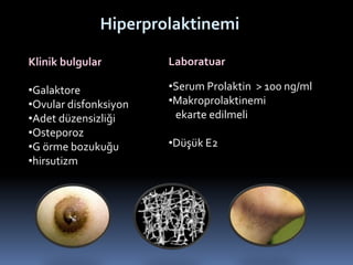 Hiperprolaktinemi
Klinik bulgular
•Galaktore
•Ovular disfonksiyon
•Adet düzensizliği
•Osteporoz
•G örme bozukuğu
•hirsutizm
Laboratuar
•Serum Prolaktin > 100 ng/ml
•Makroprolaktinemi
ekarte edilmeli
•Düşük E2
 
