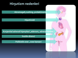 Akromegali,cushing, prolaktinoma
Hipotiroidi
Konjenital adrenal hiperplazi ,adenom, adrenal kanser
Polikistik over , over kanseri
Hirşutizm nedenleri
İnsülin direnci
 