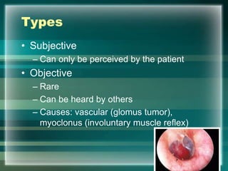 Types
• Subjective
– Can only be perceived by the patient
• Objective
– Rare
– Can be heard by others
– Causes: vascular (glomus tumor),
myoclonus (involuntary muscle reflex)
 