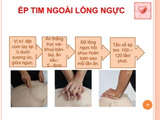 ÉP TIM NGOÀI LỒNG NGỰC
10
Vị trí: đặt
cùm tay tại
½ dưới
xương ức,
giữa ngực.
Ấn thẳng
trục vai-
khuỷ-bàn-
tay, ấn
sâu :
5 - 6cm
Để lồng
ngực hồi
phục hoàn
toàn sau
mỗi lần ấn.
Tần số ép
tim: 100 –
120 lần/
phút.
 