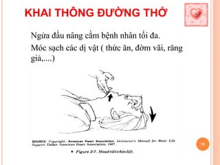 KHAI THÔNG ĐƯỜNG THỞ
Ngửa đầu nâng cằm bệnh nhân tối đa.
Móc sạch các dị vật ( thức ăn, đờm vãi, răng
giả,....)
11
 