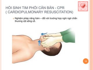HỒI SINH TIM PHỔI CĂN BẢN - CPR
( CARDIOPULMONARY RESUSCITATION)
 Nghiệm pháp nâng hàm – đối với trường hợp nghi ngờ chấn
thương cột sống cổ.
12
 