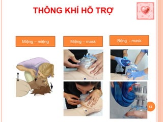 THÔNG KHÍ HỖ TRỢ
13
Miệng – miệng Miệng – mask Bóng - mask
 