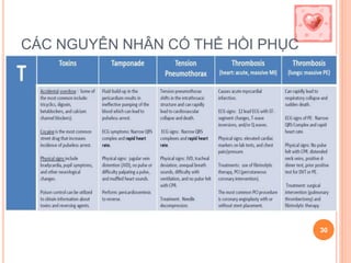 CÁC NGUYÊN NHÂN CÓ THỂ HỒI PHỤC
30
 