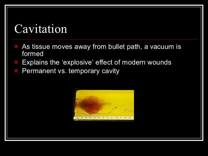 Wound Ballistics and Body Armor Paper Presentation