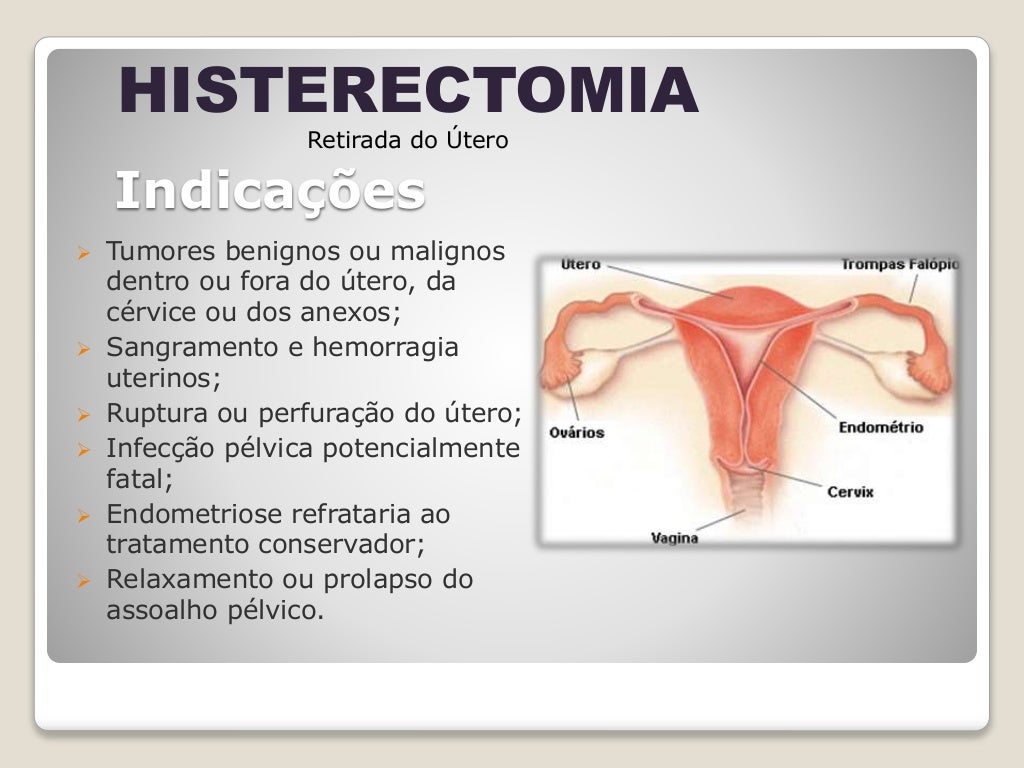 Histerectomia cuidados de enfermagem