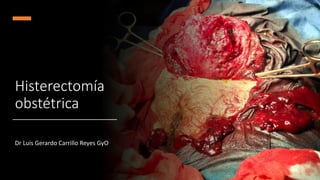 Histerectomía
obstétrica
Dr Luis Gerardo Carrillo Reyes GyO
 