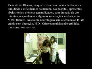 Paciente de 48 anos, há quatro dias com queixa de fraqueza dimidiada e dificuldades na marcha. No hospital, apresentou abalos tônico-clônicos generalizados, com duração de dez minutos, respondendo a algumas solicitações verbais, com MMII fletidos. Ao exame neurológico sem alterações e TC de crânio sem alteração. H.D.: Crise convulsiva não-epilética, transtorno conversivo. 