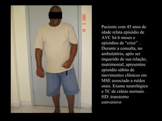 Paciente com 45 anos de idade relata episódio de AVC há 6 meses e episódios de “crise”  . Durante a consulta, no ambulatório, após ser inquerido de sua relação, matrimonial, apresentou episódio súbito de movimentos clônicos em MSE associado a ruídos orais. Exame neurológico e TC de crânio normais . HD: transtorno conversivo 
