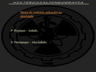 HISTEROSSALPINGOGRAFIA Meios de contraste utilizados na atualidade Hypaque – iodado. Omnipaque – não-iodado. 
