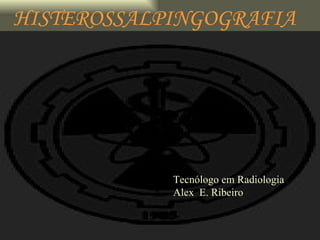 HISTEROSSALPINGOGRAFIA Tecnólogo em Radiologia Alex  E. Ribeiro 